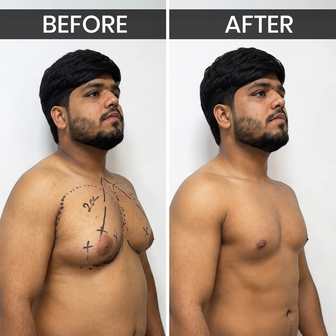 Before After