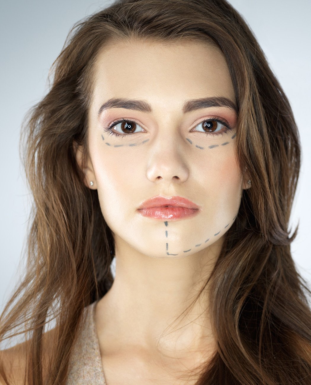 Who is an Ideal Candidate for Facelift Surgery?