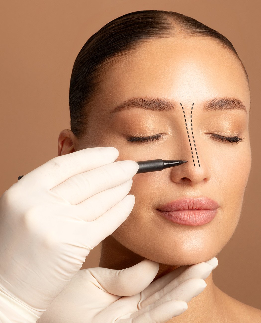 What is Rhinoplasty Surgery?