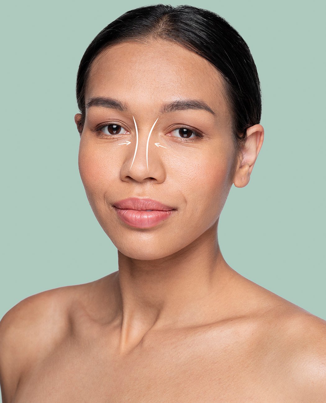 Who is an Ideal Candidate for Rhinoplasty Surgery?