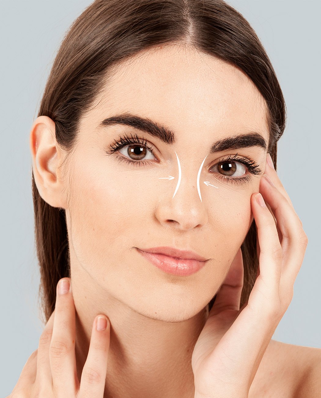 How is Rhinoplasty Surgery Performed?