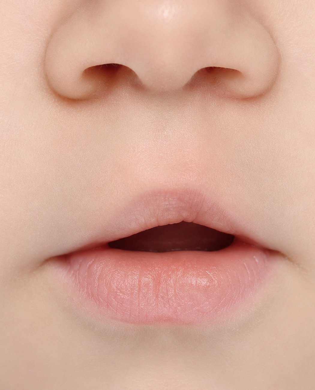 Recovery After Lip Filler Treatment: What to Expect