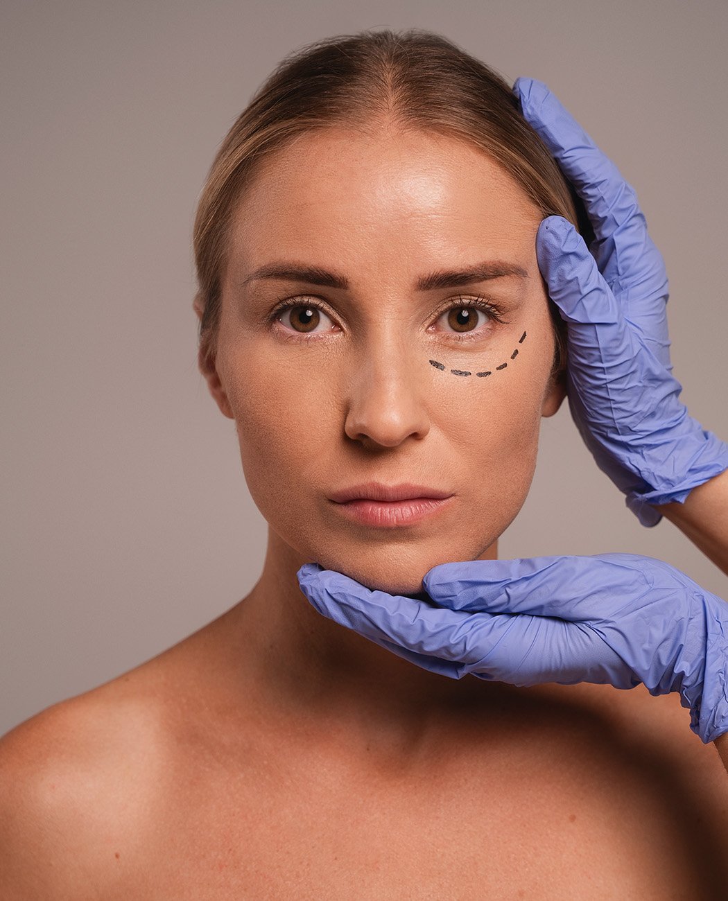 Who is an Ideal Candidate for Blepharoplasty surgery?