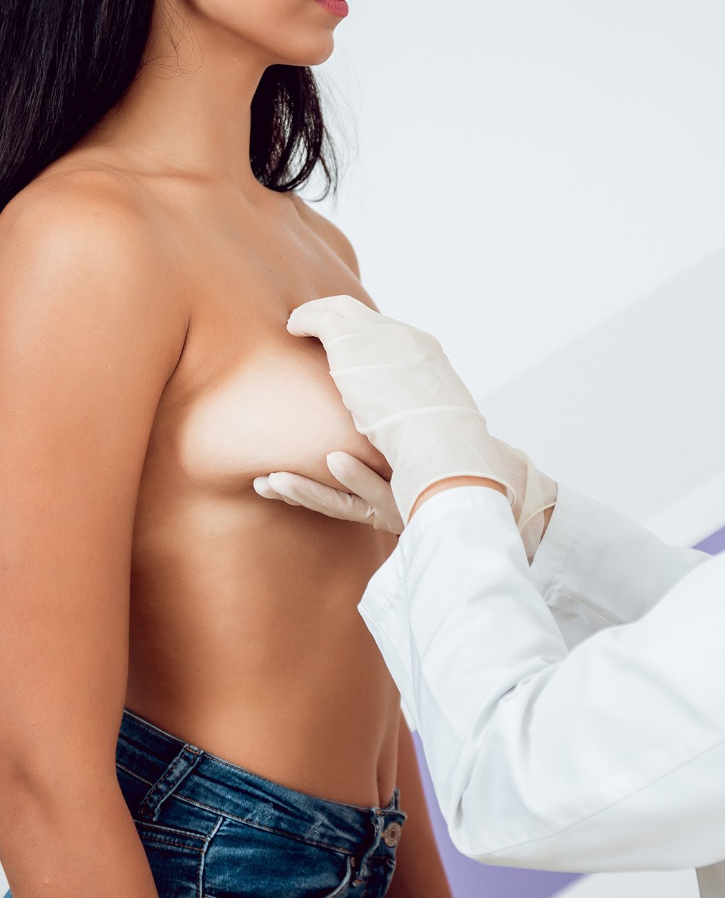 How is Breast Lift Surgery Performed?