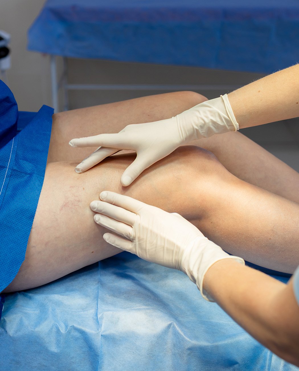 How is Thigh Lift Surgery Performed?