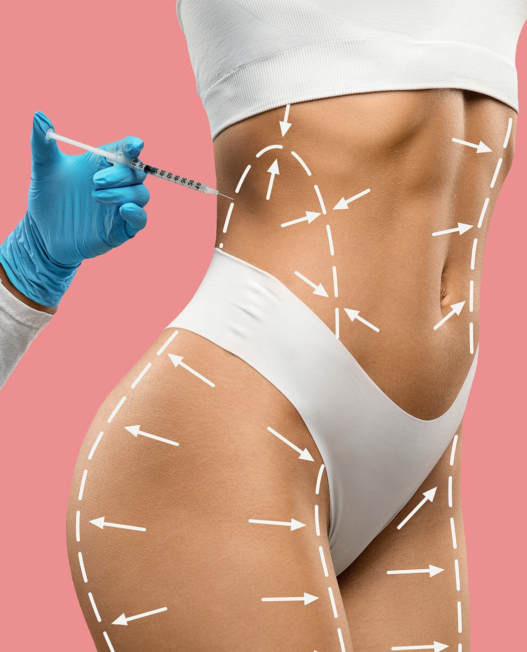 What are Fat Dissolving Injections?