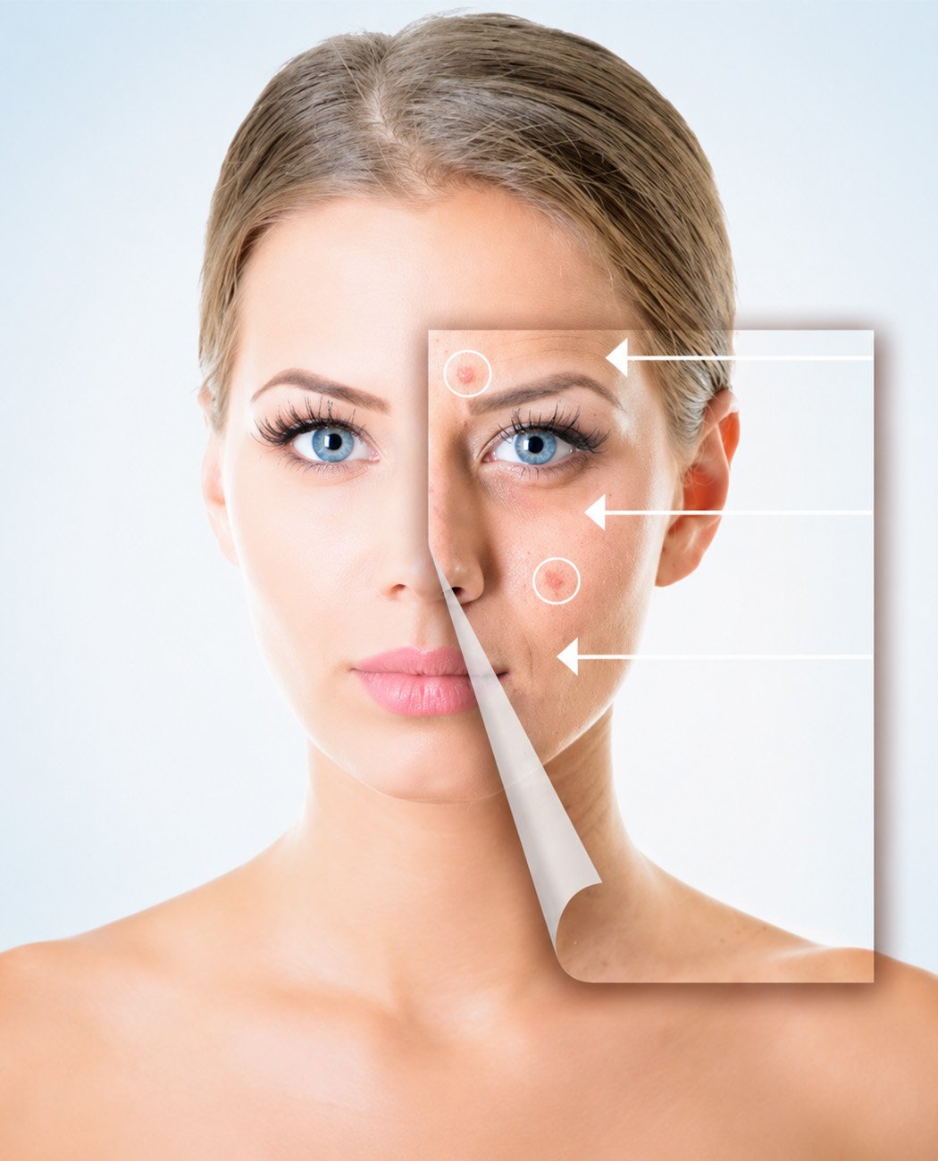 How is Laser Hair Removal treatment performed?