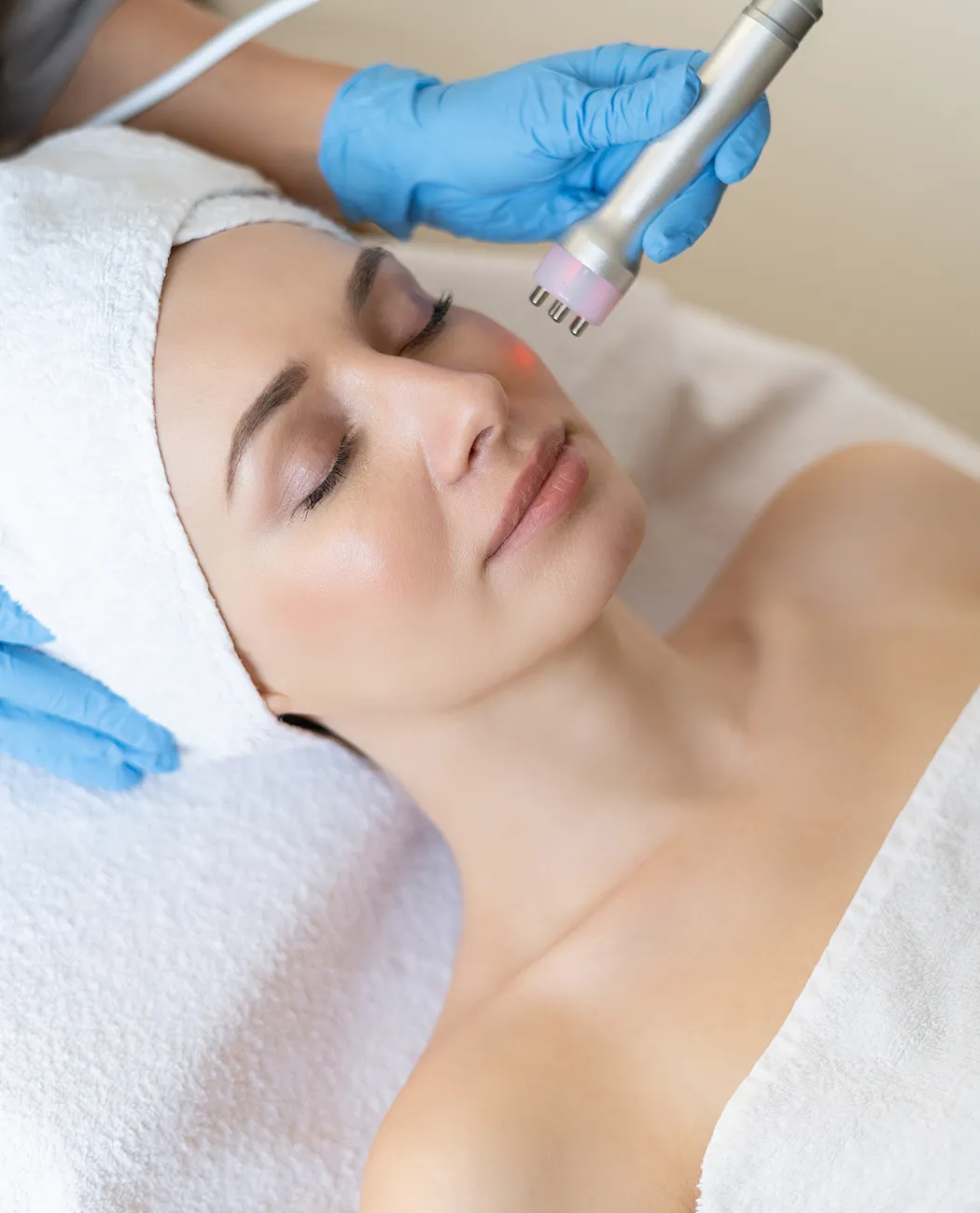 What is RF Skin Tightening Treatment?
