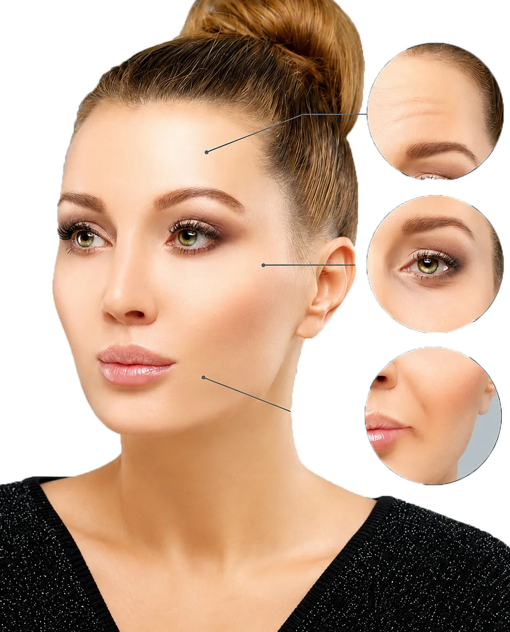 Recovery After Botox Treatment: What to Expect