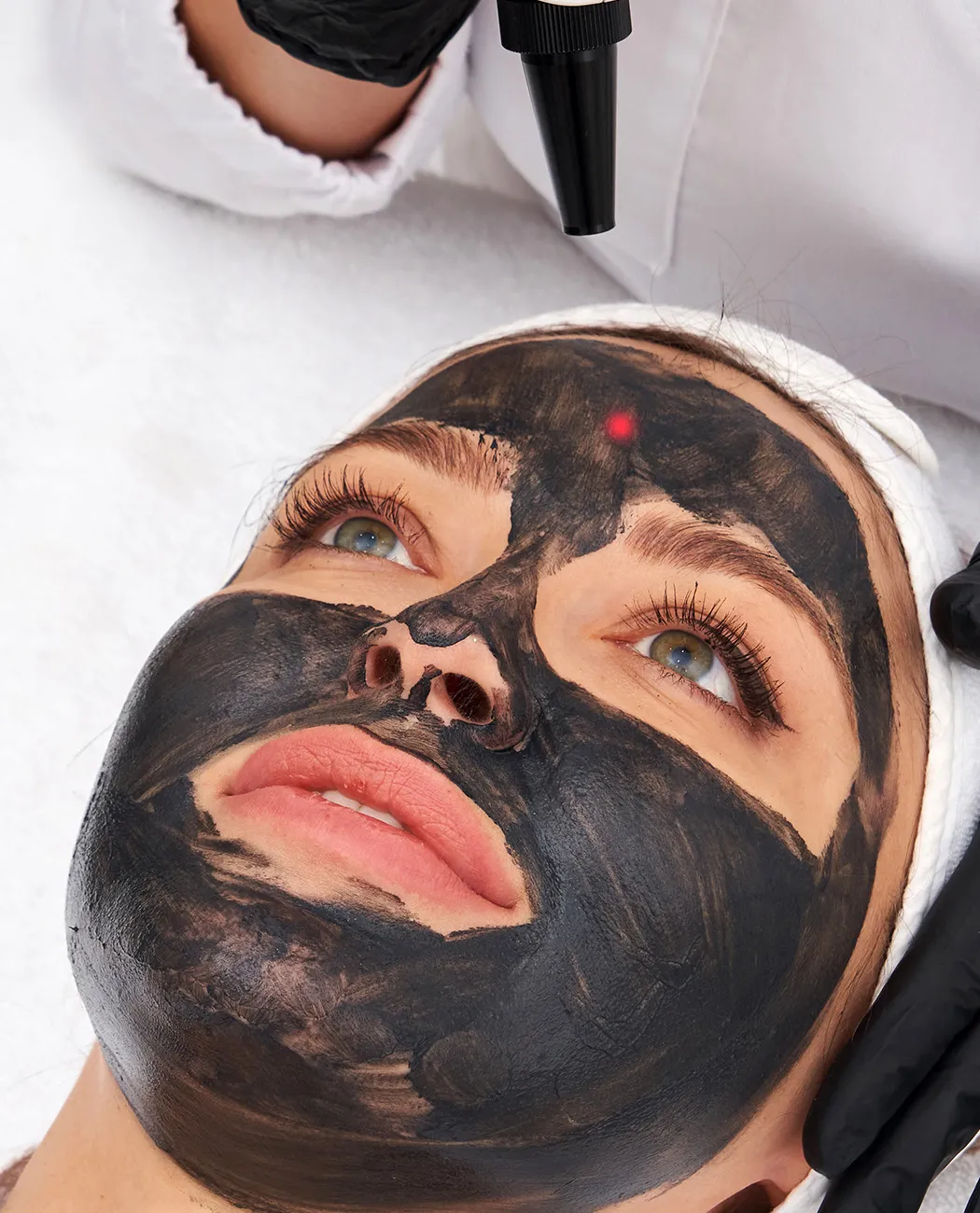 Who is an Ideal Candidate for Carbon Laser Peel Treatment?