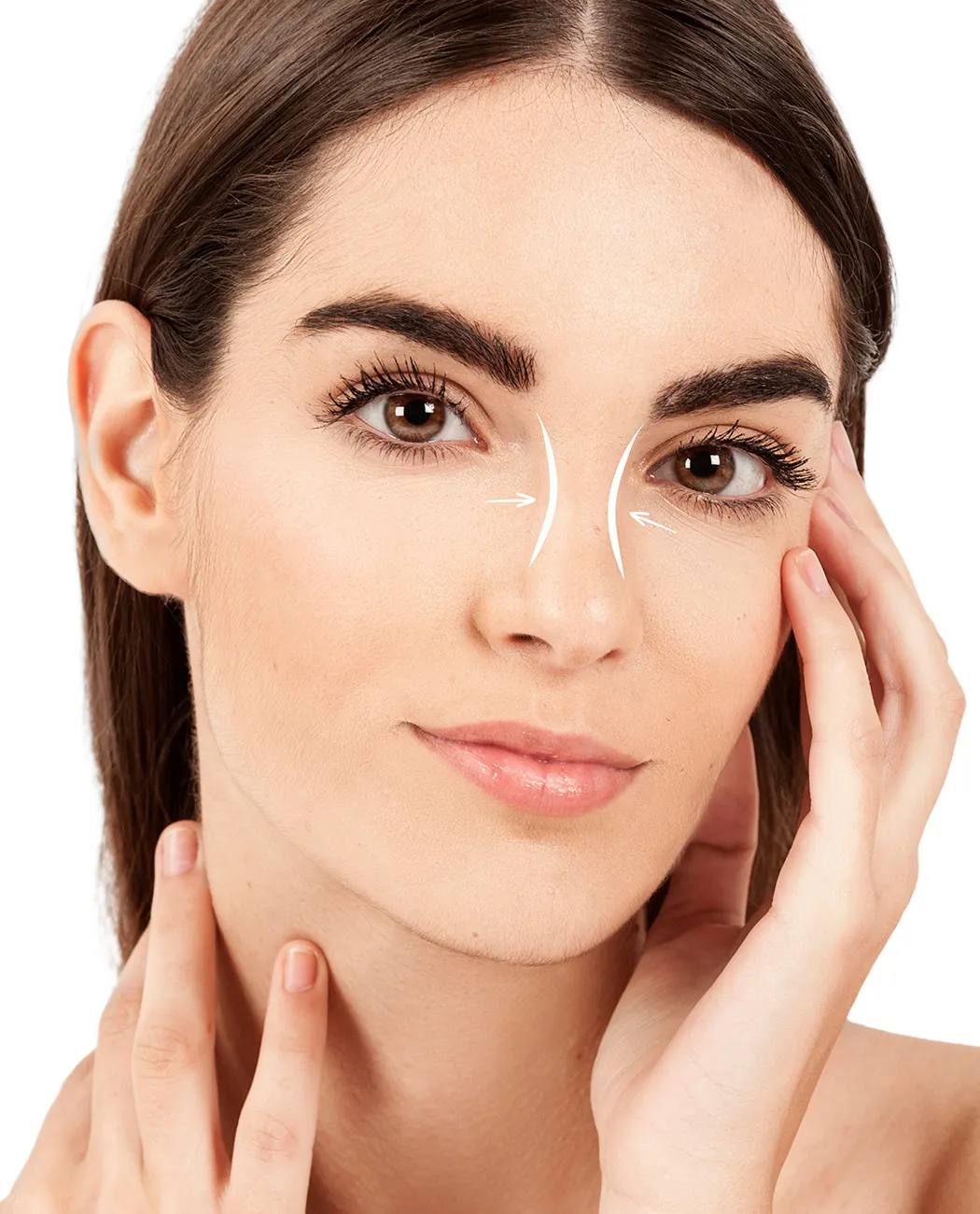 How is Rhinoplasty Surgery Performed?