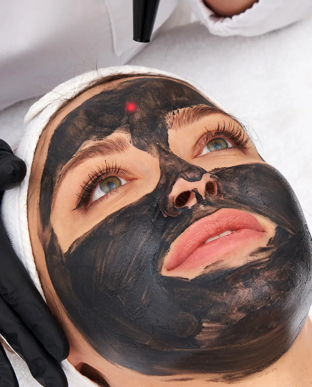 How is Carbon Laser Peel Treatment Performed?
