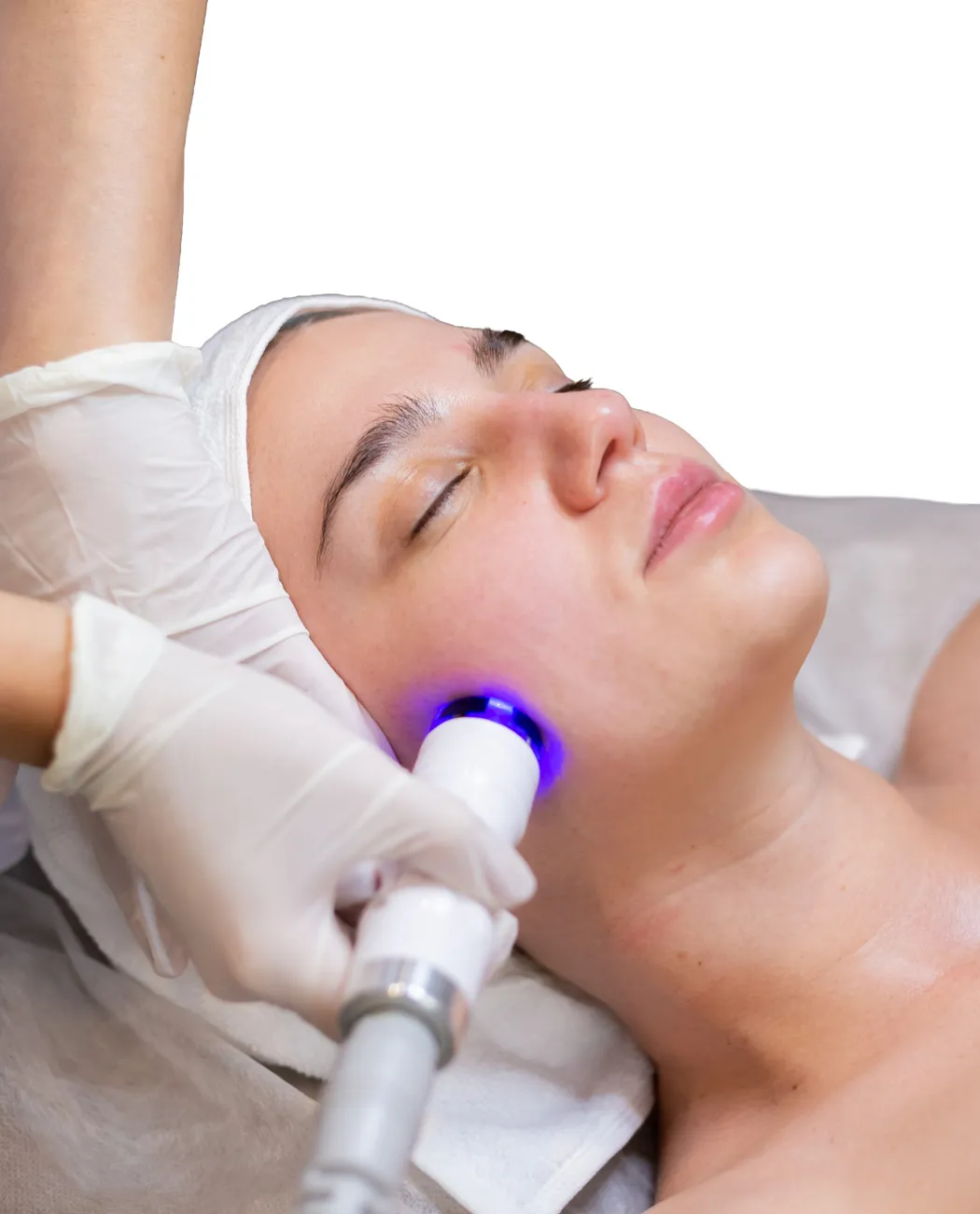 How is RF Skin Tightening Treatment Performed?