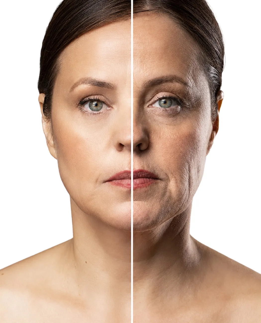 Recovery After RF Skin Tightening Treatment: What to Expect