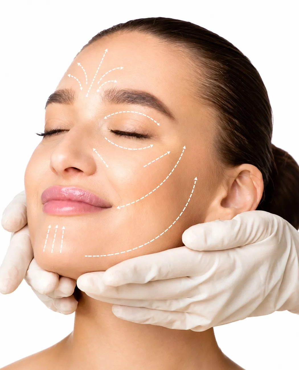 What is Facial Fat Grafting?